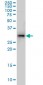 TGIF2 Antibody (monoclonal) (M01)