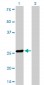 TGIF2 Antibody (monoclonal) (M01)