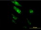 TGIF2 Antibody (monoclonal) (M06)