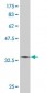 TGIF2 Antibody (monoclonal) (M06)