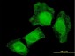 TIAM2 Antibody (monoclonal) (M01)