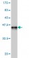 TIAM2 Antibody (monoclonal) (M01)