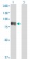 TIAM2 Antibody (monoclonal) (M01)