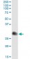 TIMP1 Antibody (monoclonal) (M01)