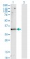 TIMP1 Antibody (monoclonal) (M01)