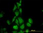 TIMP2 Antibody (monoclonal) (M01J)