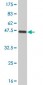 TIMP2 Antibody (monoclonal) (M01J)