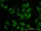 TIMP2 Antibody (monoclonal) (M02J)