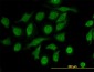 TIMP2 Antibody (monoclonal) (M03J)