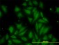 TIMP2 Antibody (monoclonal) (M04J)