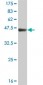 TIMP2 Antibody (monoclonal) (M04J)