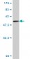 TK1 Antibody (monoclonal) (M05)