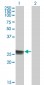 TK1 Antibody (monoclonal) (M05)