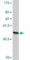 TLN1 Antibody (monoclonal) (M06)