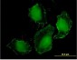 TLR9 Antibody (monoclonal) (M03)