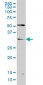 TLX3 Antibody (monoclonal) (M01)