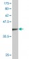 TLX3 Antibody (monoclonal) (M02)