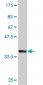 TNFRSF10B Antibody (monoclonal) (M01)