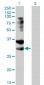 TNFRSF14 Antibody (monoclonal) (M01)
