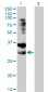 TNFRSF14 Antibody (monoclonal) (M01)
