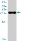 TNFRSF17 Antibody (monoclonal) (M01)