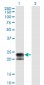 TNFRSF17 Antibody (monoclonal) (M01)