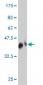 TNFRSF19L Antibody (monoclonal) (M01)