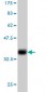TNFRSF6B Antibody (monoclonal) (M02)