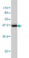 TNFSF12 Antibody (monoclonal) (M01)
