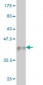 TNKS Antibody (monoclonal) (M01)