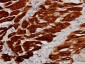 TNNC1 Antibody (monoclonal) (M01)