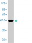 TNNC1 Antibody (monoclonal) (M01)