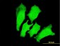 TNNI3 Antibody (monoclonal) (M04)