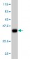 TNNI3 Antibody (monoclonal) (M04)