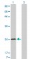 TNNI3 Antibody (monoclonal) (M04)