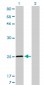 TNNI3 Antibody (monoclonal) (M04)