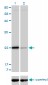 TNNI3 Antibody (monoclonal) (M04)