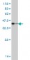 TNNT3 Antibody (monoclonal) (M02)