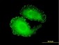 TNS4 Antibody (monoclonal) (M01)