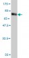TNS4 Antibody (monoclonal) (M01)