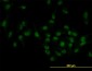 TOE1 Antibody (monoclonal) (M02)