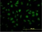 TOE1 Antibody (monoclonal) (M03)