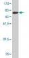 TOE1 Antibody (monoclonal) (M03)