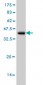TOM1 Antibody (monoclonal) (M01)