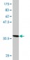 TOM1 Antibody (monoclonal) (M06)