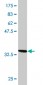 TOM1 Antibody (monoclonal) (M06)