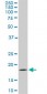 TOMM22 Antibody (monoclonal) (M01)