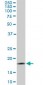 TOMM22 Antibody (monoclonal) (M01)