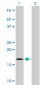 TOMM22 Antibody (monoclonal) (M01)