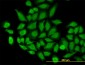TOMM22 Antibody (monoclonal) (M01)